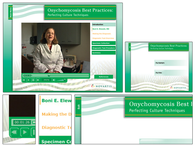 Onychomycosis Best Practices
